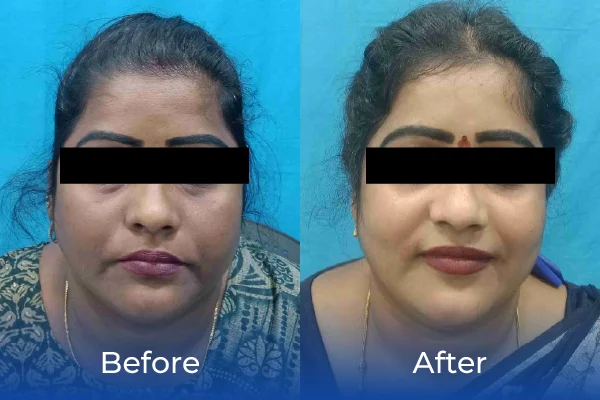 hair treatment specialist